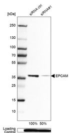 Western blot analysis in Caco-2 cells transfected with control siRNA, target specific siRNA probe #1, using Anti-EPCAM antibody. Remaining relative intensity is presented. Loading control: Anti-PPIB.