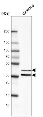 Western blot analysis in human cell line CAPAN-2.