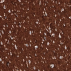 Immunohistochemical staining of human cerebral cortex shows strong positivity in neuropil.