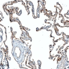 Immunohistochemical staining of human lung shows moderate membranous positivity in pneumocytes.