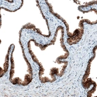 Immunohistochemical staining of human prostate shows strong membranous positivity in glandular cells.