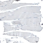 Immunohistochemical staining of human skeletal muscle shows no positivity in striated muscle fibers as expected.