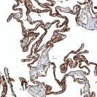 Immunohistochemical staining of human lung shows strong membranous positivity in pneumocytes.