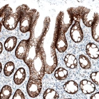 Immunohistochemical staining of human colon shows strong membranous positivity in glandular cells.