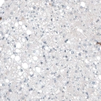 Immunohistochemical staining of human liver shows no positivity in hepatocytes as expected.