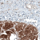 Immunohistochemical staining of human urinary bladder shows strong membranous positivity in smooth muscle cells.