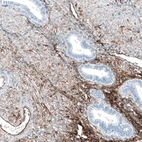 Immunohistochemical staining of human endometrium shows moderate membranous positivity in smooth muscle cells.