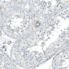 Anti-ITGA5 Antibody