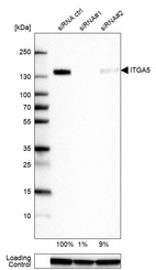 Anti-ITGA5 Antibody