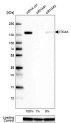 Western blot analysis in U-87MG ATCC cells transfected with control siRNA, target specific siRNA probe #1 and #2, using Anti-ITGA5 antibody. Remaining relative intensity is presented. Loading control: Anti-GAPDH.