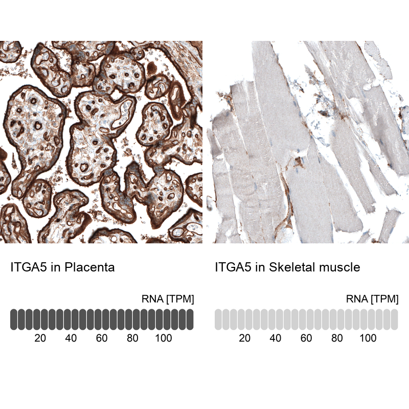 Anti-ITGA5 Antibody