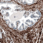 Immunohistochemical staining of human prostate shows strong membranous positivity in smooth muscle cells.