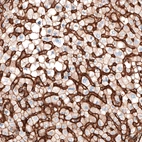 Immunohistochemical staining of human liver shows strong positivity in liver sinusoids.