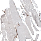 Immunohistochemical staining of human skeletal muscle shows no positivity in striated muscle fibers as expected.
