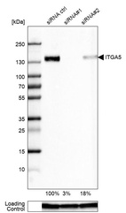 Western blot analysis in U-87MG ATCC cells transfected with control siRNA, target specific siRNA probe #1 and #2, using Anti-ITGA5 antibody. Remaining relative intensity is presented. Loading control: Anti-GAPDH.