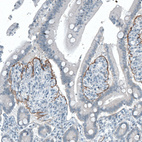 Anti-ITGB4 Antibody