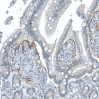 Immunohistochemical staining of human small intestine shows moderate positivity in basement membrane of glandular cells.