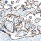 Immunohistochemical staining of human placenta shows moderate to strong positivity in basement membrane of trophoblastic cells.
