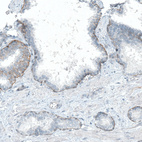 Anti-ITGB4 Antibody