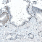 Immunohistochemical staining of human prostate shows moderate positivity in basement membrane of glandular cells.