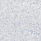 Anti-ITGB4 Antibody