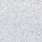 Immunohistochemical staining of human liver shows no positivity as expected.