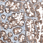 Anti-ITGB4 Antibody