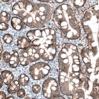 Immunohistochemical staining of human duodenum shows moderate membranous immunoreactivity in glandular cells and strong positivity in basement membrane.