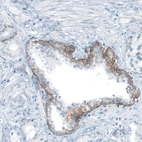 Immunohistochemical staining of human prostate shows moderate membranous positivity in glandular cells.
