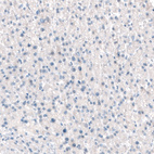 Immunohistochemical staining of human liver shows no positivity in hepatocytes as expected.