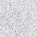 Anti-ITGB4 Antibody