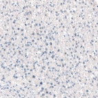 Immunohistochemical staining of human liver shows no positivity in hepatocytes as expected.