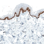 Immunohistochemical staining of human skin shows strong membranous positivity in cells in basal layer of epidermis.