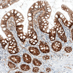 Immunohistochemical staining of human small intestine shows moderate to strong membranous positivity in glandular cells.