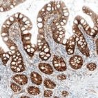 Immunohistochemical staining of human small intestine shows moderate to strong membranous positivity in glandular cells.