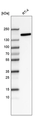 Western blot analysis in human cell line RT-4.