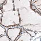 Immunohistochemical staining of human thyroid gland shows moderate membranous positivity in glandular cells.