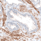 Immunohistochemical staining of human prostate shows moderate membranous positivity in smooth muscle cells.