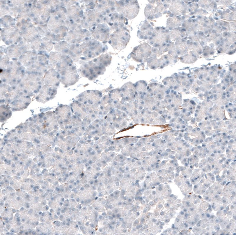 Mouse Monoclonal AntiITGB3 Antibody Buy for research Highly