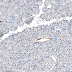 Immunohistochemical staining of human pancreas shows no positivity in exocrine glandular cells as expected.