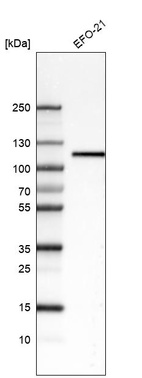 Western blot analysis in human cell line EFO-21.